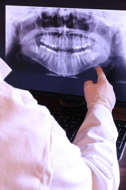 Best Chipped Tooth Repair Near Me  in Tellico Village, TN
